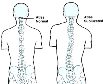 spine align chiropractic